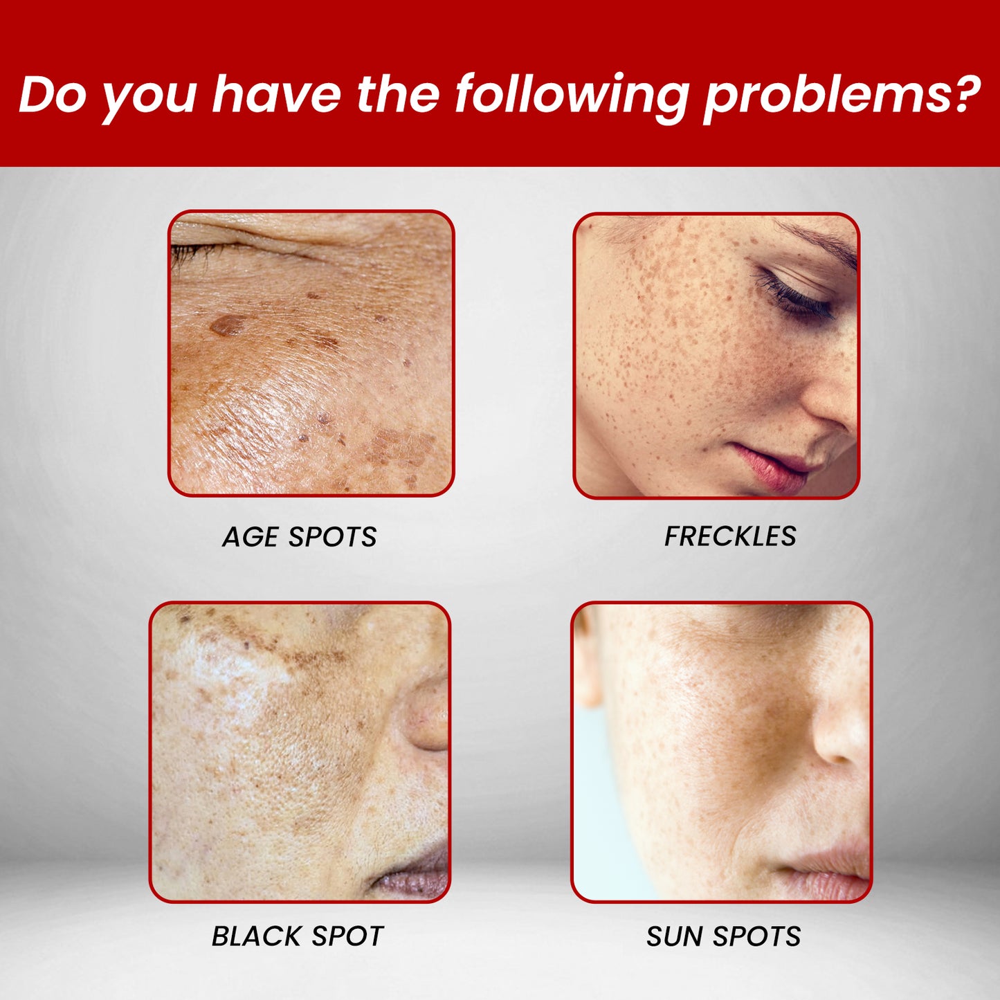 Dark Spot Removal Cream, Moisturizing Repair Lighten Face Fine Lines And Spots Skin Whitening Cream