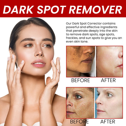 Dark Spot Removal Cream, Moisturizing Repair Lighten Face Fine Lines And Spots Skin Whitening Cream