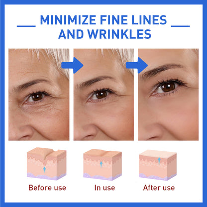 Collagen Facial Essence Reduces Fine Lines, Tightens Skin And Improves Dull Skin