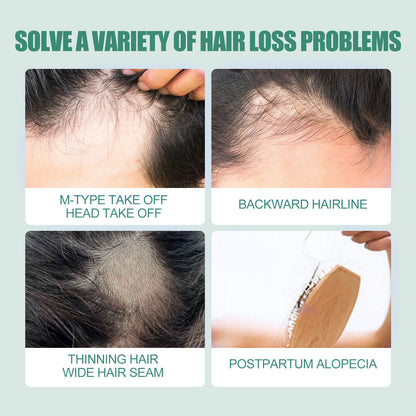 7 Days Essence Gently Moisturizes Hydrating Hairline Scalp Root Nourishing Hair Care Essential Oil